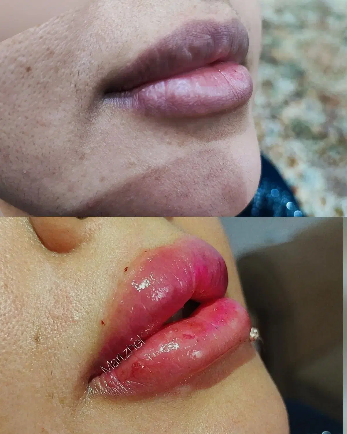 تزریق ژل بوتاکس چال گونه تتو پرسینگ مژه و اموزش|خدمات آرایشگری و زیبایی|اهواز, معین زاده|دیوار