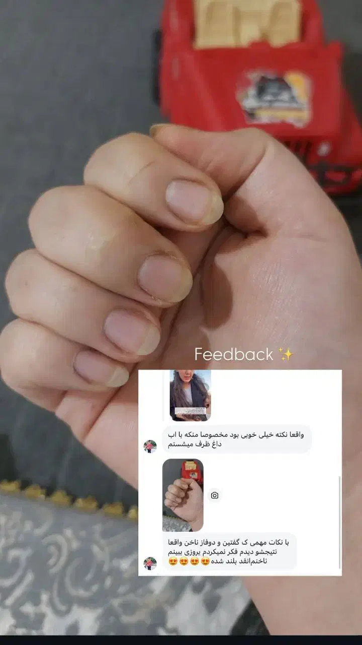 سرمدوفازناخن|آرایشی، بهداشتی، درمانی|جوانرود, |دیوار