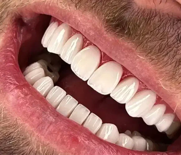 دندان  پزشکی|پزشکی|رشت, سلیمانداراب|دیوار