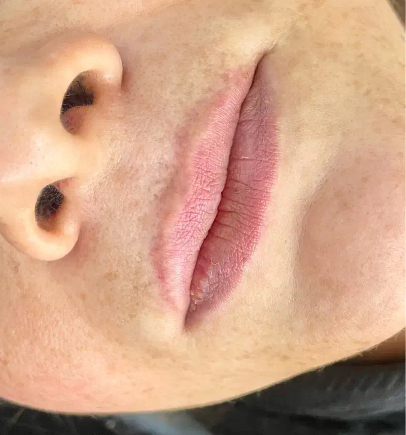 پاک کردن تتو ابرو چشم لب ریموو تضمینی ۱۰۰٪|خدمات آرایشگری و زیبایی|یاسوج, |دیوار