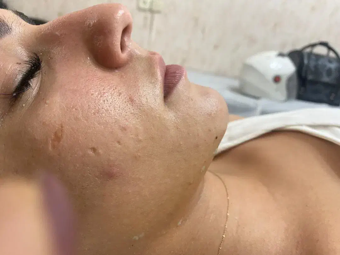 فیشال درمانی تخصصی|خدمات آرایشگری و زیبایی|بندر ماهشهر, |دیوار