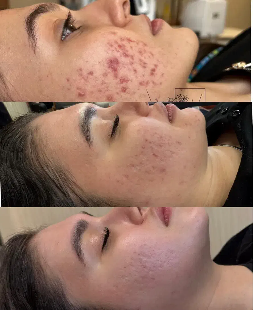 ژل ،بوتاکس، کوچک کردن بینی ،جوانسازی در کیلینیک|خدمات آرایشگری و زیبایی|کرمانشاه, |دیوار