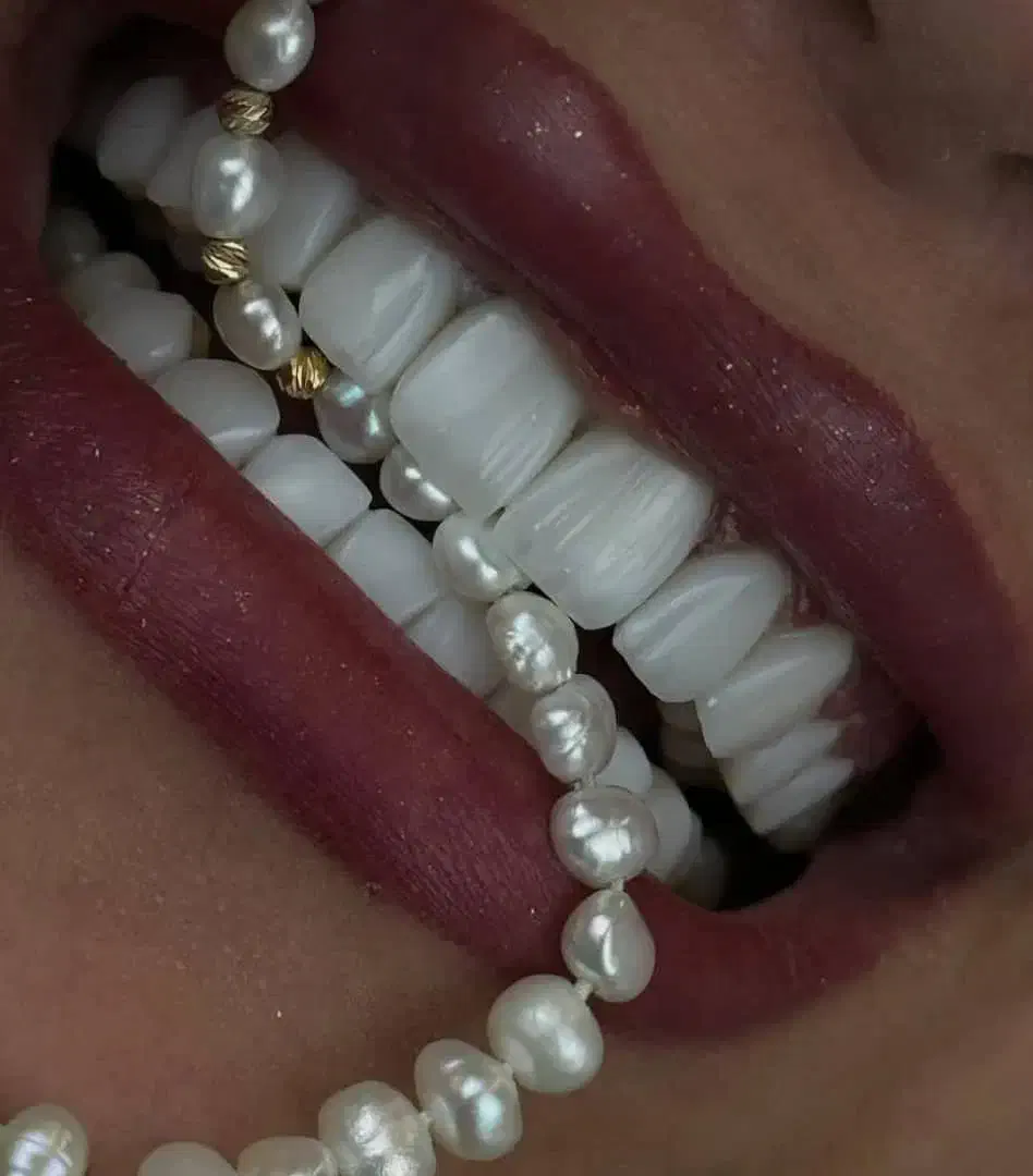 جشنواره کامپوزیت لمینیت عصب کشی روکش imax|خدمات آرایشگری و زیبایی|تهران, اقدسیه|دیوار