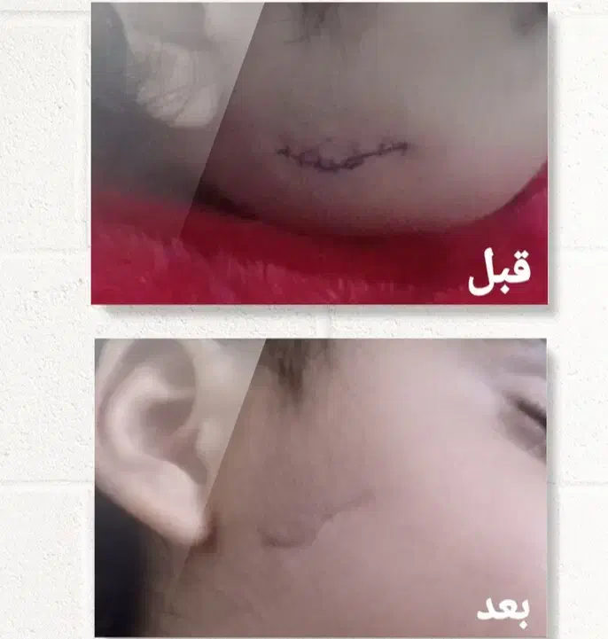 درمان پوست ومو|آرایشی، بهداشتی، درمانی|نهبندان, |دیوار