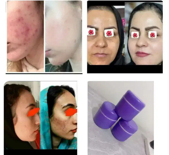 ارسال رایگان|آرایشی، بهداشتی، درمانی|خاش, |دیوار