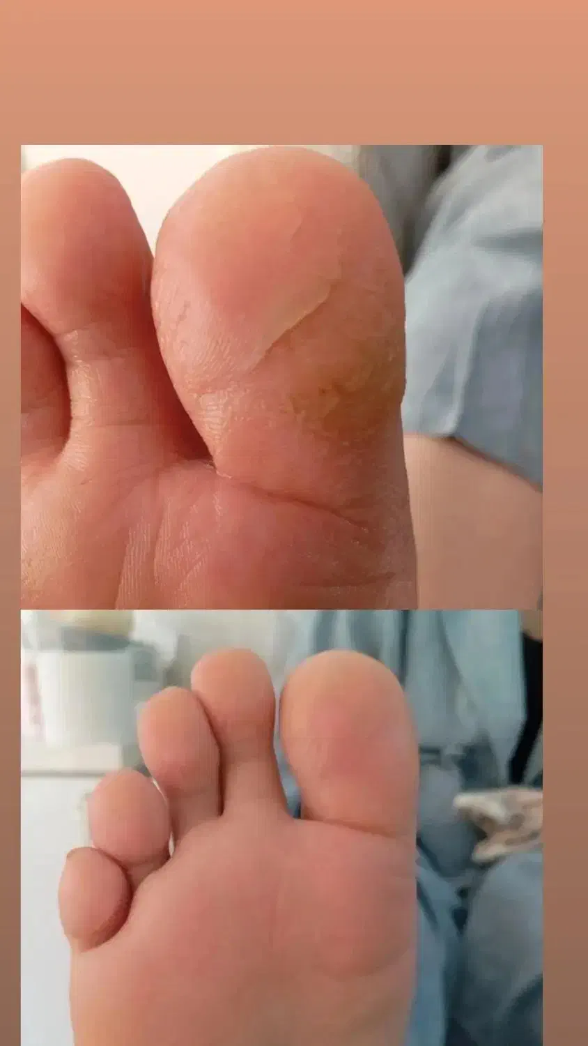 پدیکور  حرفه ای در مهاباد|خدمات آرایشگری و زیبایی|مهاباد (آذربایجان غربی), |دیوار