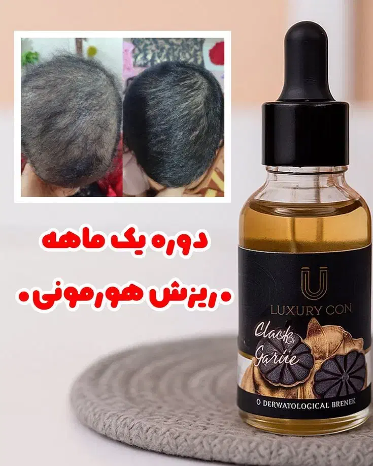 درمان قطعی ریزش مو وموخوره|آرایشی، بهداشتی، درمانی|سراوان, |دیوار