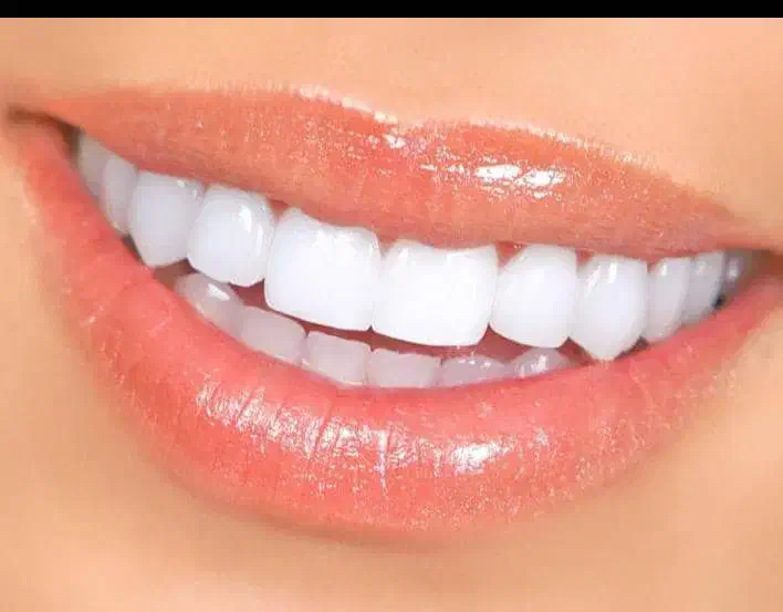 جشنواره دندانپزشکی افسریه|خدمات آرایشگری و زیبایی|تهران, افسریه شمالی|دیوار