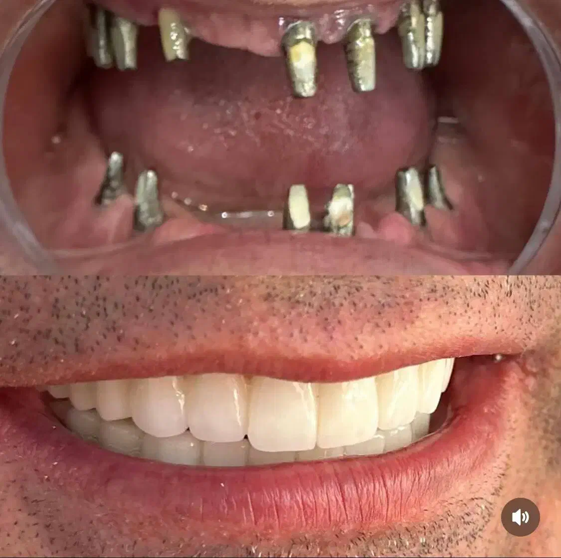 مرکز تخصصی دندانپزشکی ایمپلنت شرایط ویژه اقساطی|خدمات آرایشگری و زیبایی|تبریز, |دیوار