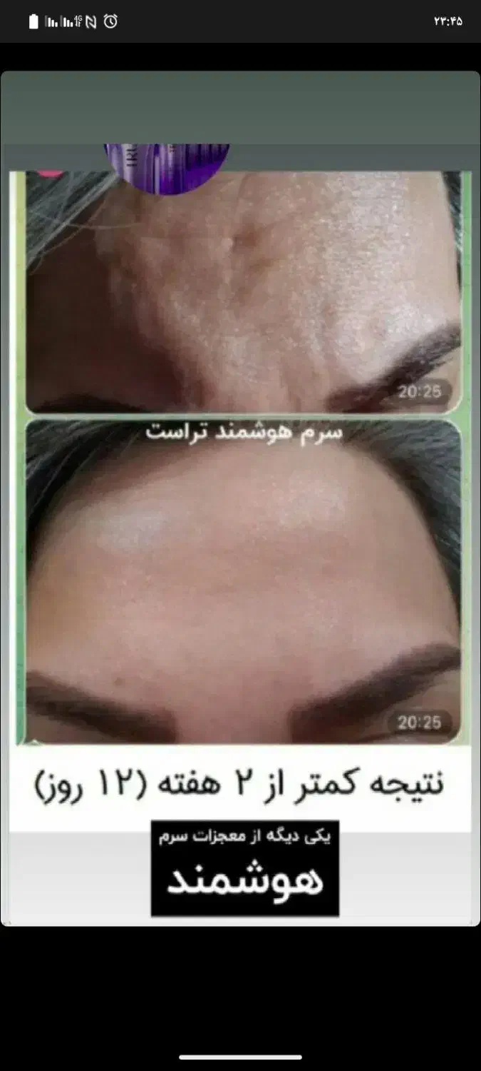 زیبایی پوستی محصولات مراقبتی|آرایشی، بهداشتی، درمانی|رباط‌کریم, شهرستانک|دیوار