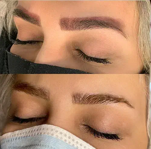 ریموو و پاک کردن تخصصی تاتو توسط مستر ریموو|خدمات آرایشگری و زیبایی|تهران, دهکده المپیک|دیوار