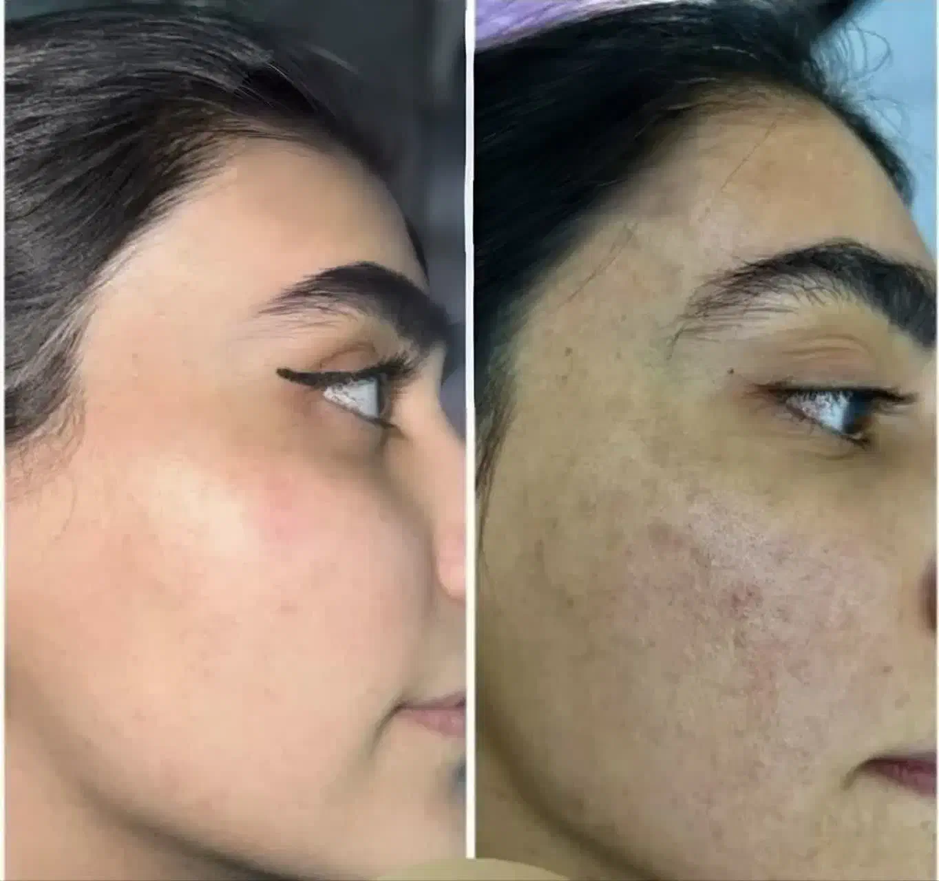 پک صابون و سرم شیر الاغ برطرف کننده لک و جوش صورت|آرایشی، بهداشتی، درمانی|زابل, |دیوار