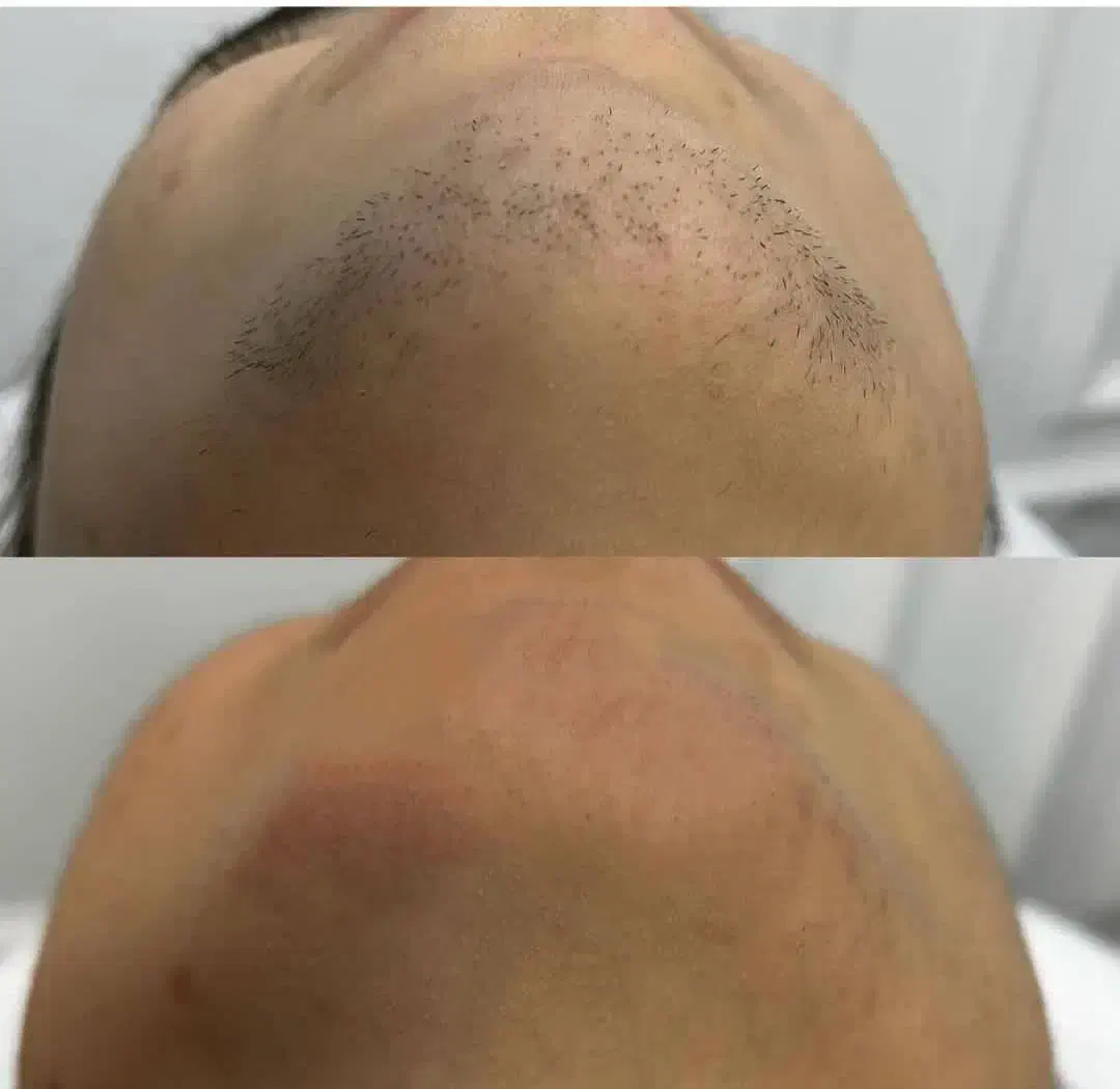 تخصصی پوست و مو و لیزر|خدمات آرایشگری و زیبایی|یاسوج, |دیوار