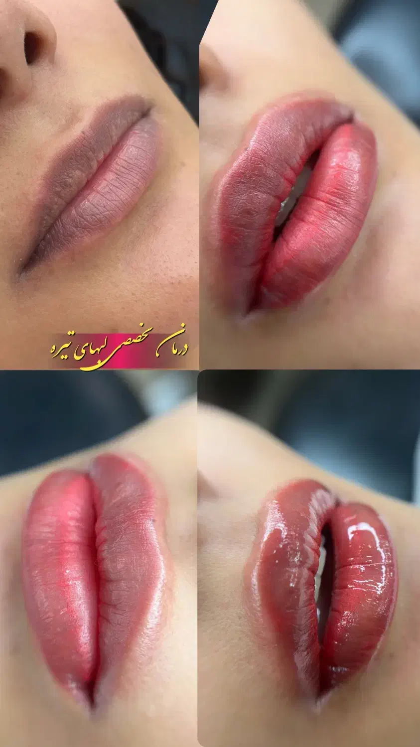 مدل لب کبود|خدمات آرایشگری و زیبایی|گرگان, |دیوار