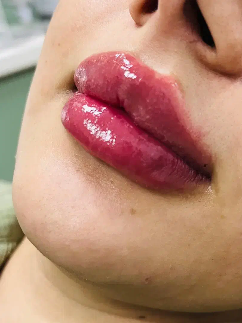 جشنواره ویژه کاشت ابرو ،بوتاکس، فیلر ..|خدمات آرایشگری و زیبایی|بوشهر, |دیوار