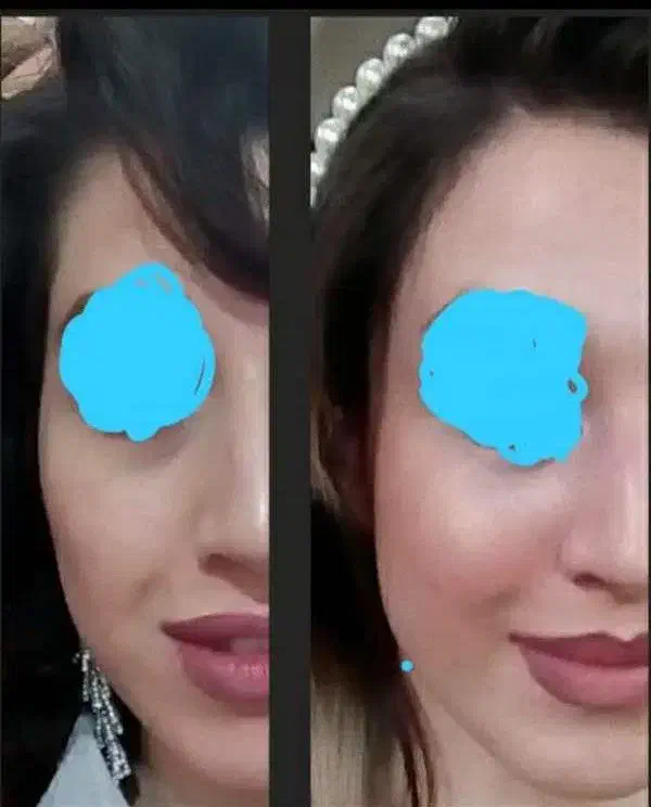 خدمات تخصصی پوست و مو در کلینیک فرسیما|خدمات آرایشگری و زیبایی|اسلام‌شهر, باغ فیض|دیوار