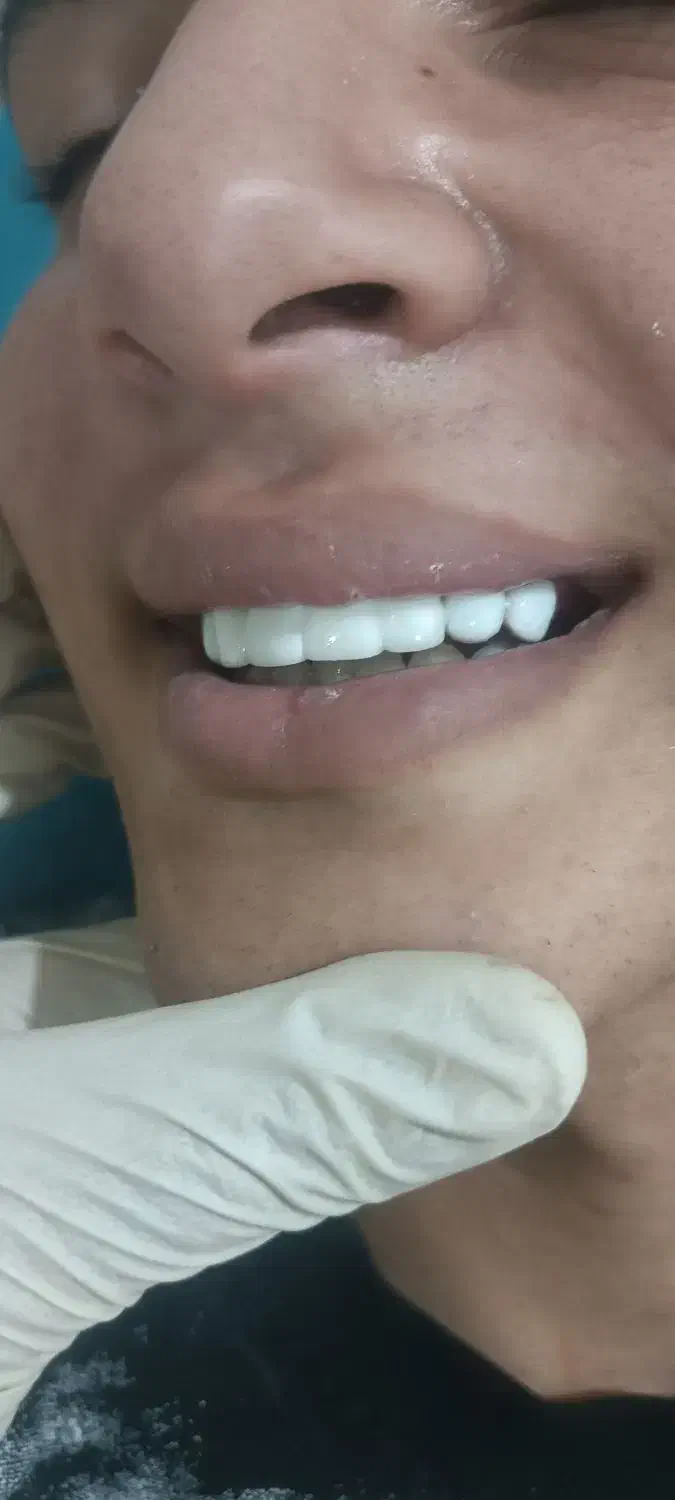 دندان سازی.دندان پزشکی|خدمات آرایشگری و زیبایی|خرم‌آباد, |دیوار