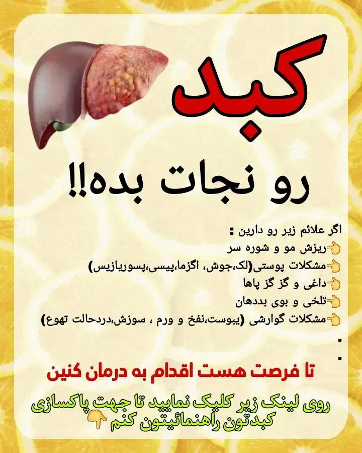 کبد|خدمات آرایشگری و زیبایی|شاهین دژ, |دیوار