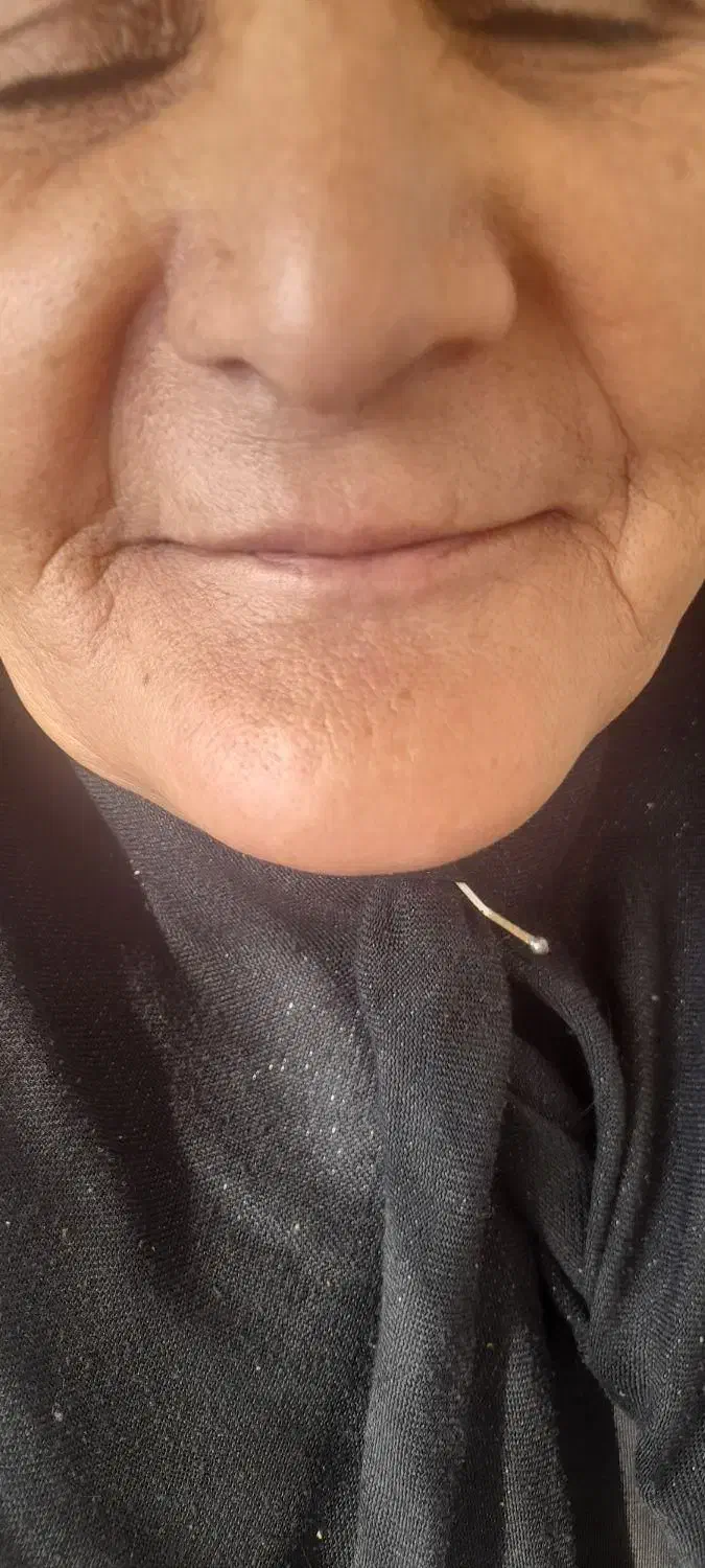 ندانسازی ۲۰درصدتخفیف|خدمات آرایشگری و زیبایی|تربت‌حیدریه, باغ ملی|دیوار