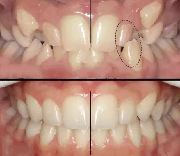 جراحی دندان عقل، عصب کشی، ارتودنسی|خدمات آرایشگری و زیبایی|زنجان, |دیوار