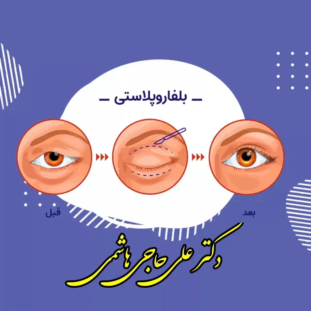 زیبائی پلک بالا و پائین|خدمات آرایشگری و زیبایی|لنجان, |دیوار