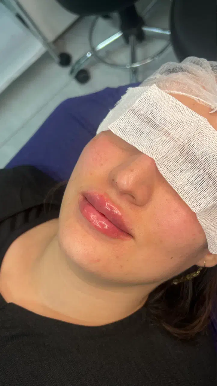 قیمتهای استثنایی کلینیک زیبایی تزریق فیلر ،بوتاکس|خدمات آرایشگری و زیبایی|نسیمشهر, |دیوار