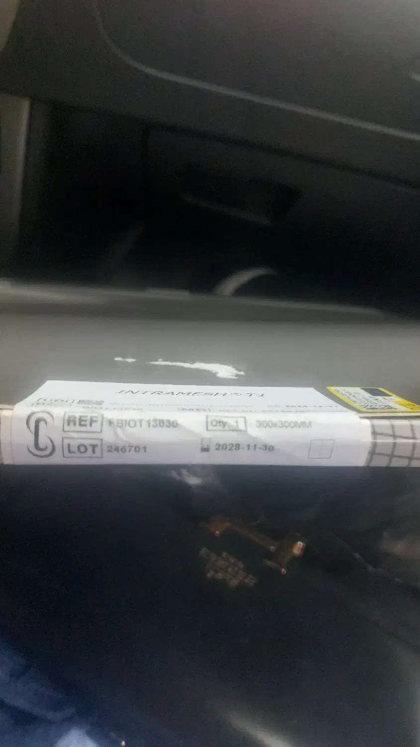 دووال مِش برای جراحی فتق|پزشکی|رودسر, |دیوار