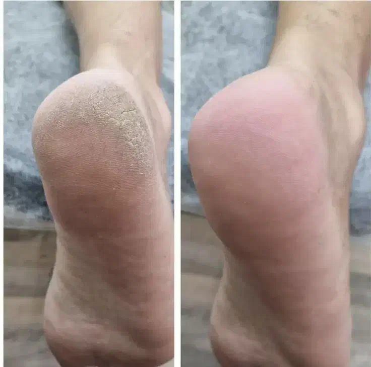 اپیلاسیون کل بدن ۵۵۰ اموزش ۱۸۰۰ فقط پدیکور ۵۰۰|خدمات آموزشی|زاهدان, |دیوار