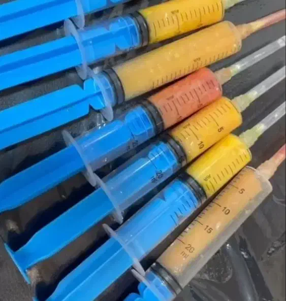 تزریق چربی به صورت وساکشن شکم وپهلو|خدمات آرایشگری و زیبایی|نهاوند, |دیوار