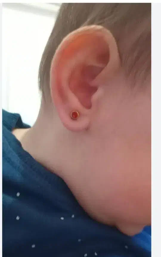 انجام پاکسازی صورت وسوراخ کردن گوش|خدمات آرایشگری و زیبایی|اسدآباد, |دیوار