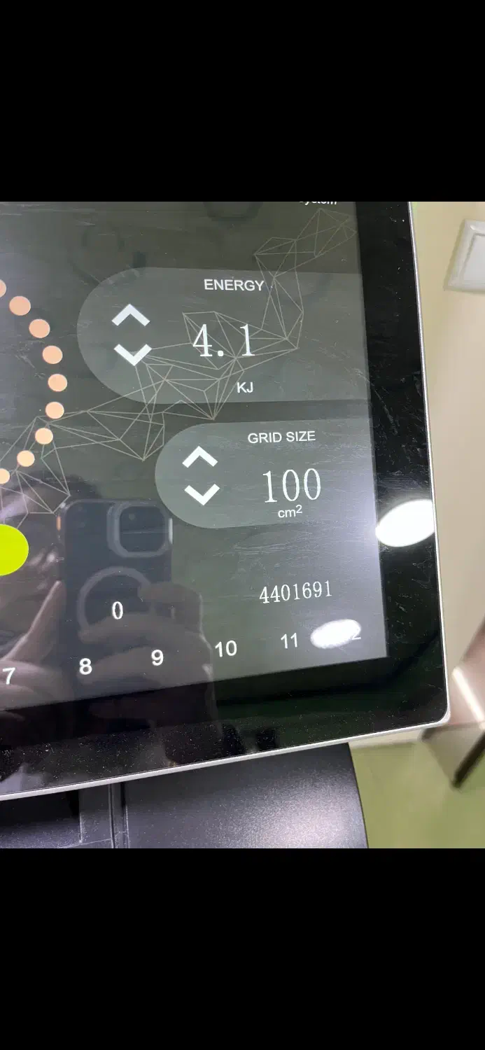 دستگاه سوپرانیوم تیتانیوم اصلی گرید a|پزشکی|رشت, قاسمیه|دیوار