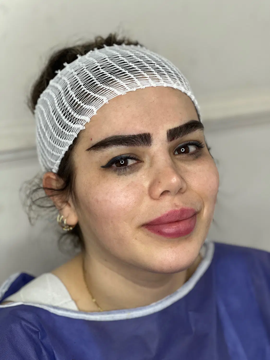 کاشت ابرو به روش جراحی فقط۱۱تومان|خدمات زیبایی و سلامت|تهران, جنتآباد جنوبی|دیوار