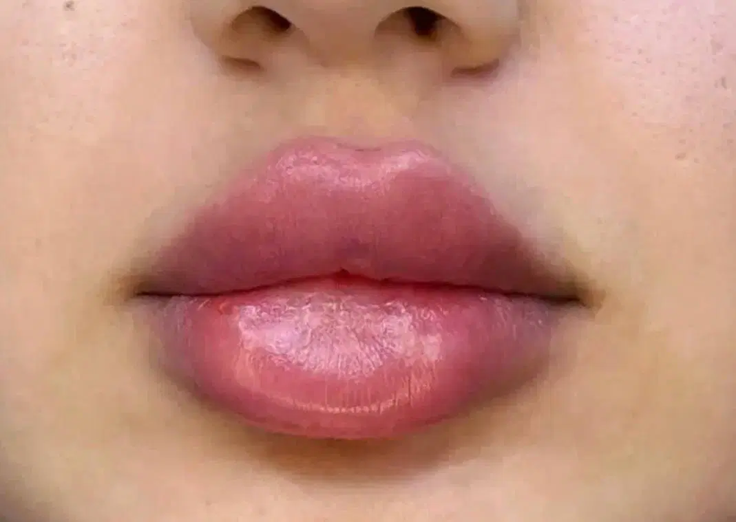 ارائه خدمات تخصصی ژل و بوتاکس|خدمات زیبایی و سلامت|شیراز, فرهنگ شهر|دیوار