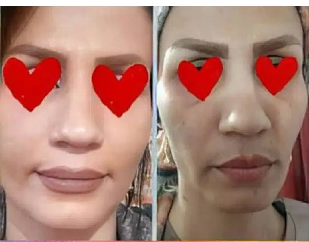 صورتت رو تاعید تپل کن وشاداب کن|آرایشی، بهداشتی، درمانی|میان جلگه, |دیوار