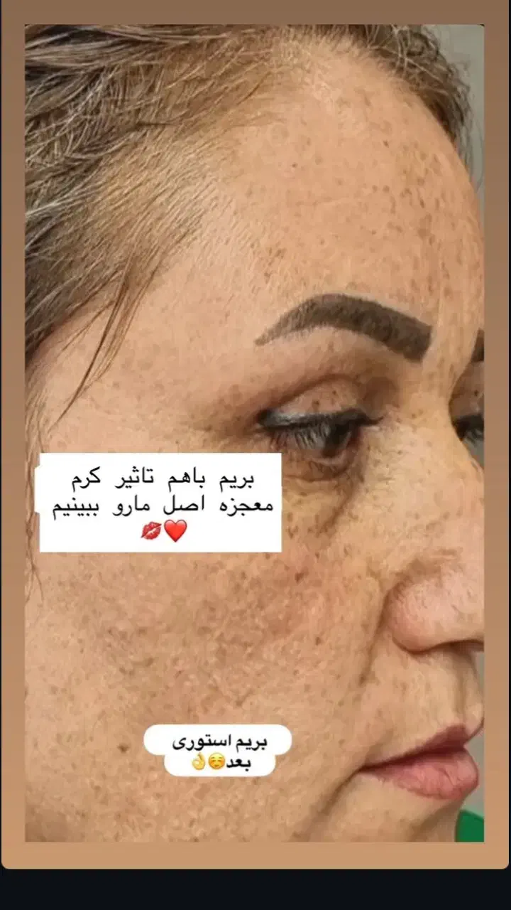 کرم معجزه شب|آرایشی، بهداشتی، درمانی|بندر گز, |دیوار