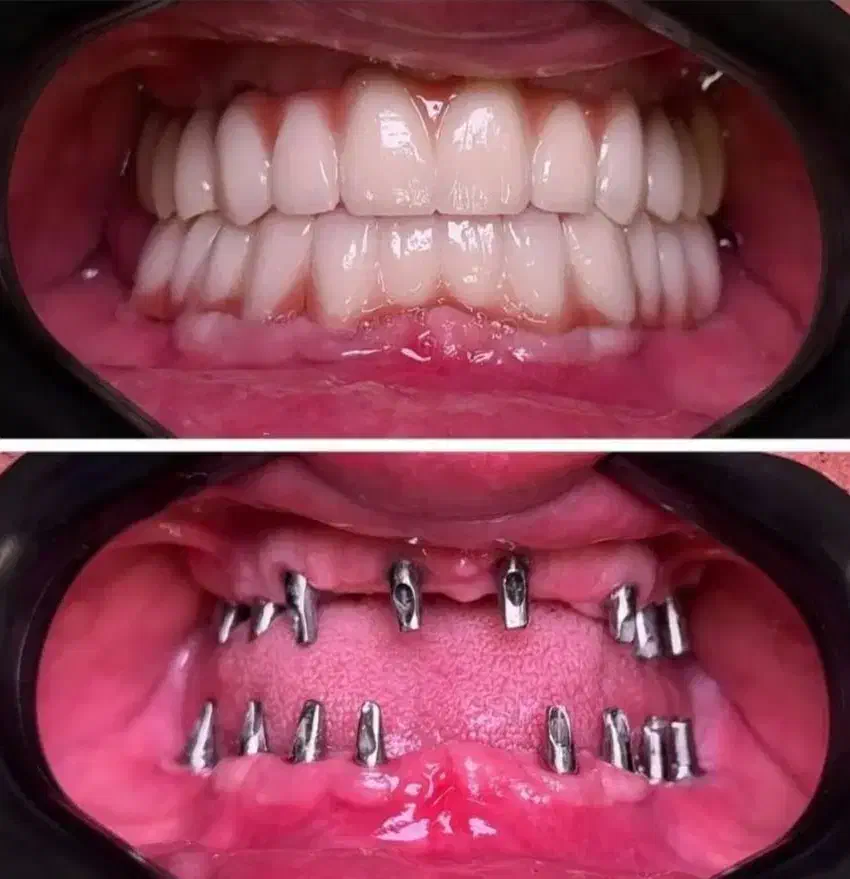 دندانپزشکی مرکز تخصصی ایمپلنت در تبریز|خدمات آرایشگری و زیبایی|مرند, |دیوار