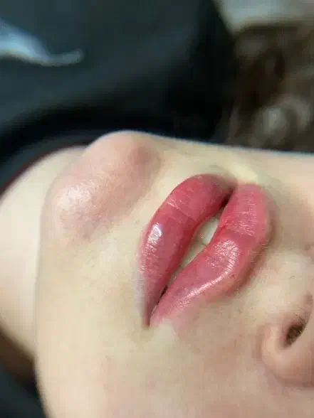 ژل لب، فیلر صورت، بوتاکس|خدمات آرایشگری و زیبایی|نجفآباد, امام خمینی|دیوار