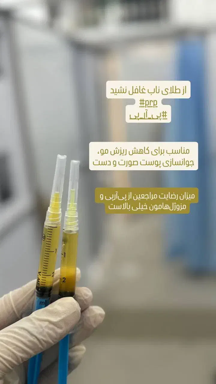 تخفیفات1 هفتهای PRP زیبایی به مناسبت یلدا|خدمات آرایشگری و زیبایی|کرمانشاه, |دیوار