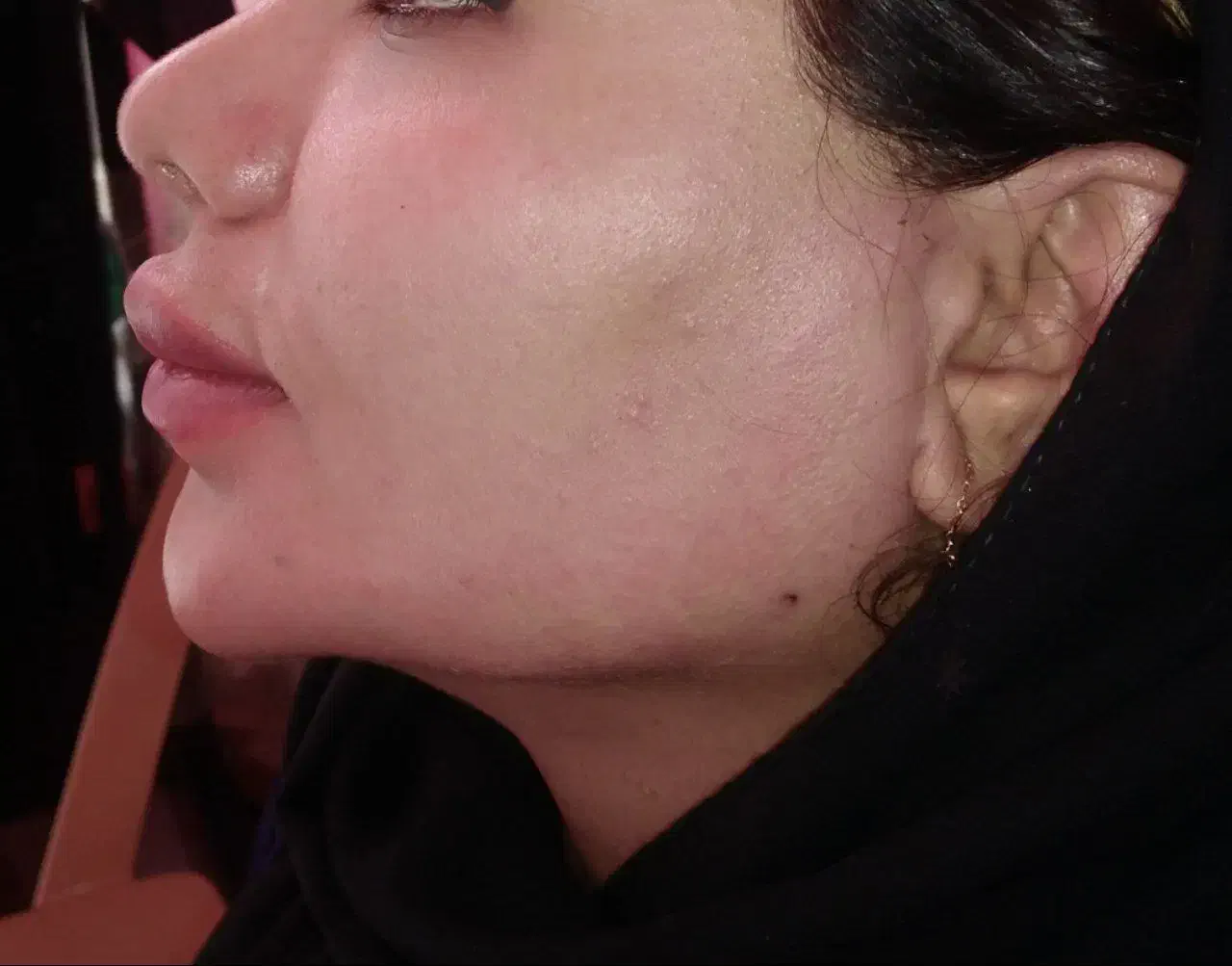 ساکشن چربی تزریق چربی|خدمات آرایشگری و زیبایی|شیراز, شهرک مطهری|دیوار