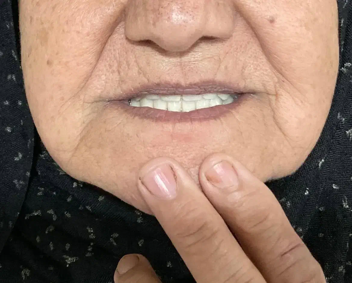 ساخت دندون مصنوعیی|پزشکی|گرگان, |دیوار