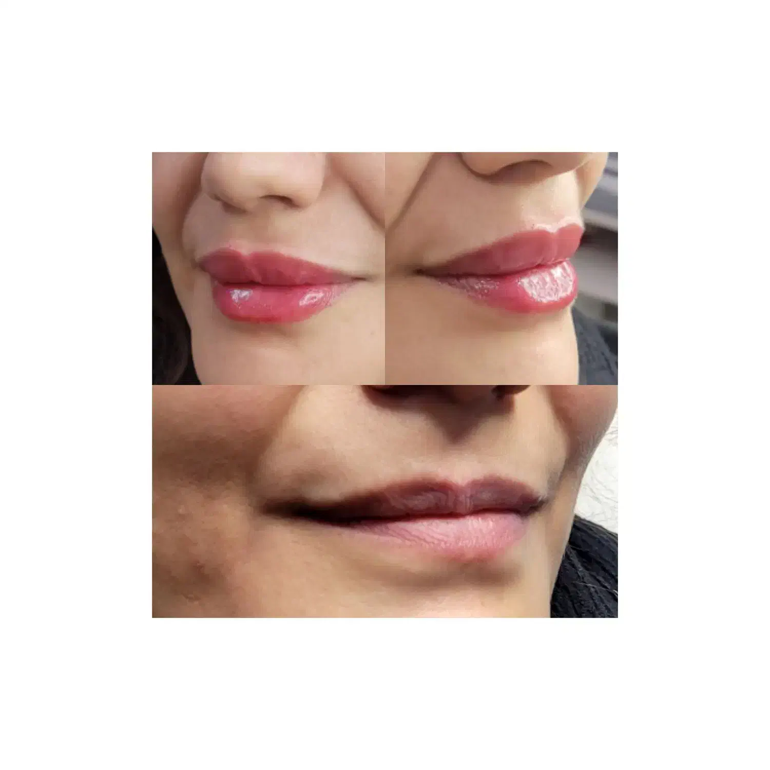 خدمات پوست و لیزر و زیبایی درمطب دکتر خلیلیان|خدمات آرایشگری و زیبایی|اصفهان, رهنان|دیوار