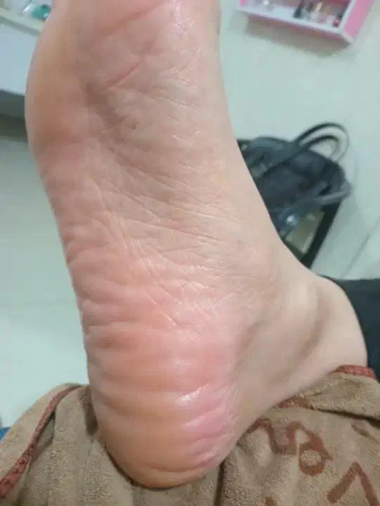 فروش وسایل پدیکور|آرایشی، بهداشتی، درمانی|اسلامآباد غرب, |دیوار