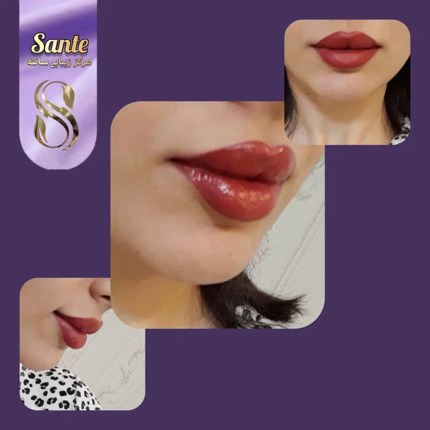 بوتاکس رایگان|خدمات آرایشگری و زیبایی|همدان, |دیوار