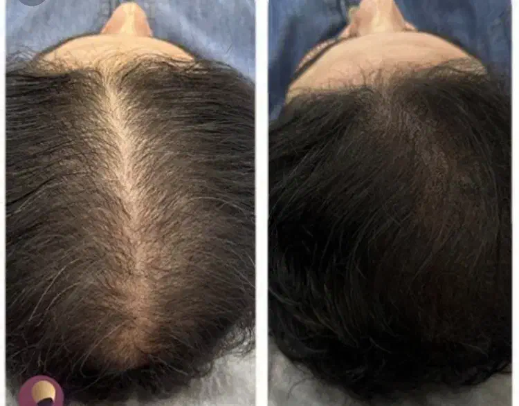 اسکالپ سر|خدمات آرایشگری و زیبایی|گرگان, |دیوار