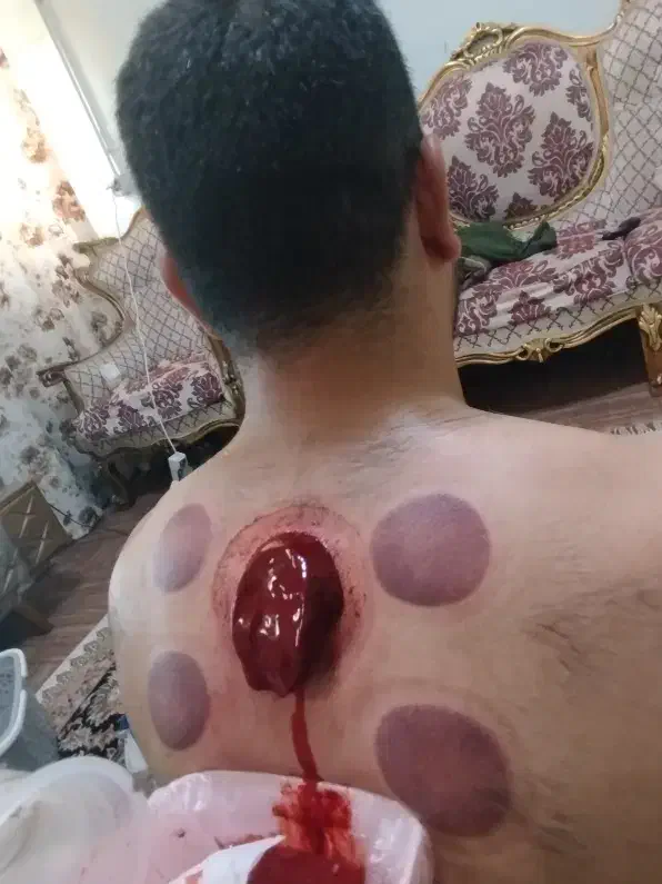 حجامت وبادکش گرم آقا وخانم|خدمات آرایشگری و زیبایی|بندرعباس, |دیوار