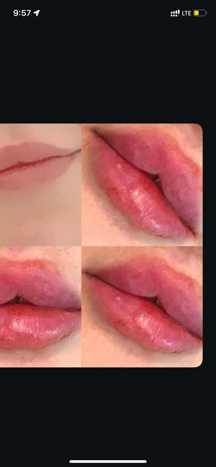 خدمات فیلر و بوتاکس|خدمات آرایشگری و زیبایی|خرمشهر, |دیوار