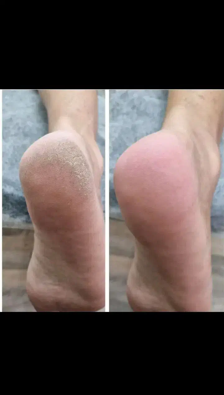 پدیکور و کفسابی با گارانتی|خدمات آرایشگری و زیبایی|اصفهان, سعادت‌آباد|دیوار