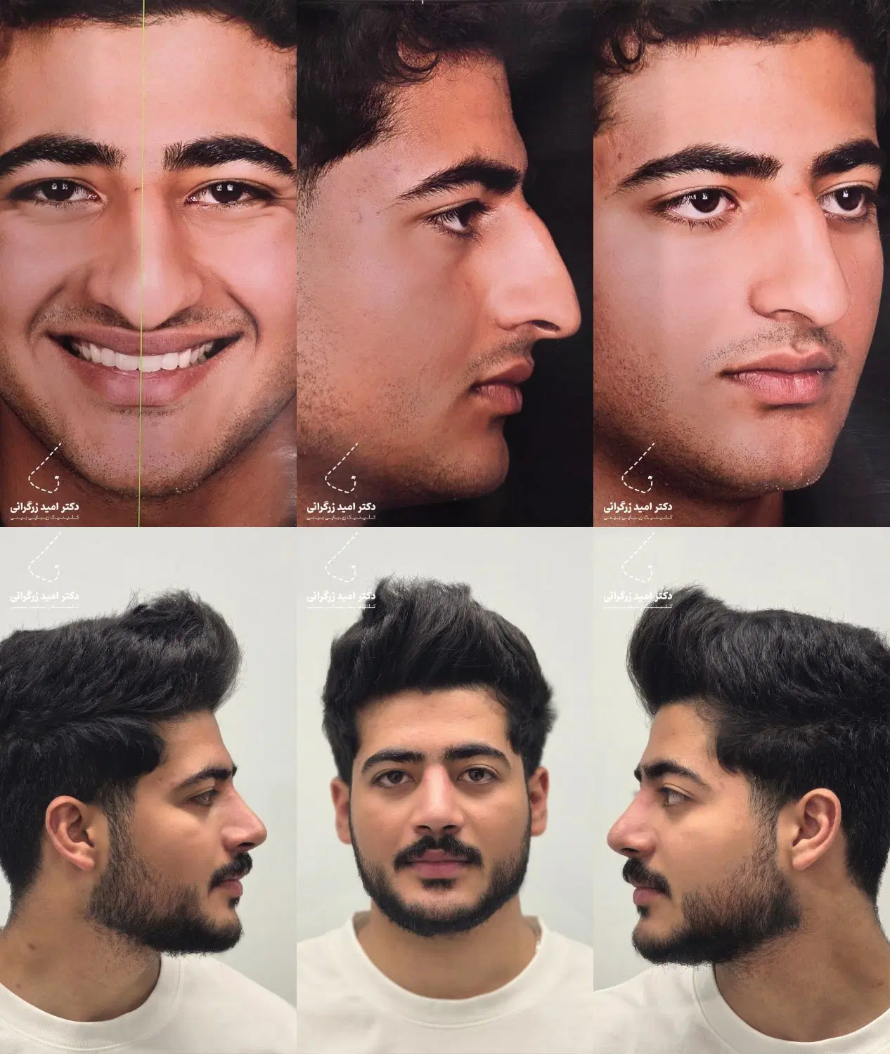 مشاوره تخصصی و رایگان عمل بینی|خدمات زیبایی و سلامت|شیراز, ستارخان|دیوار
