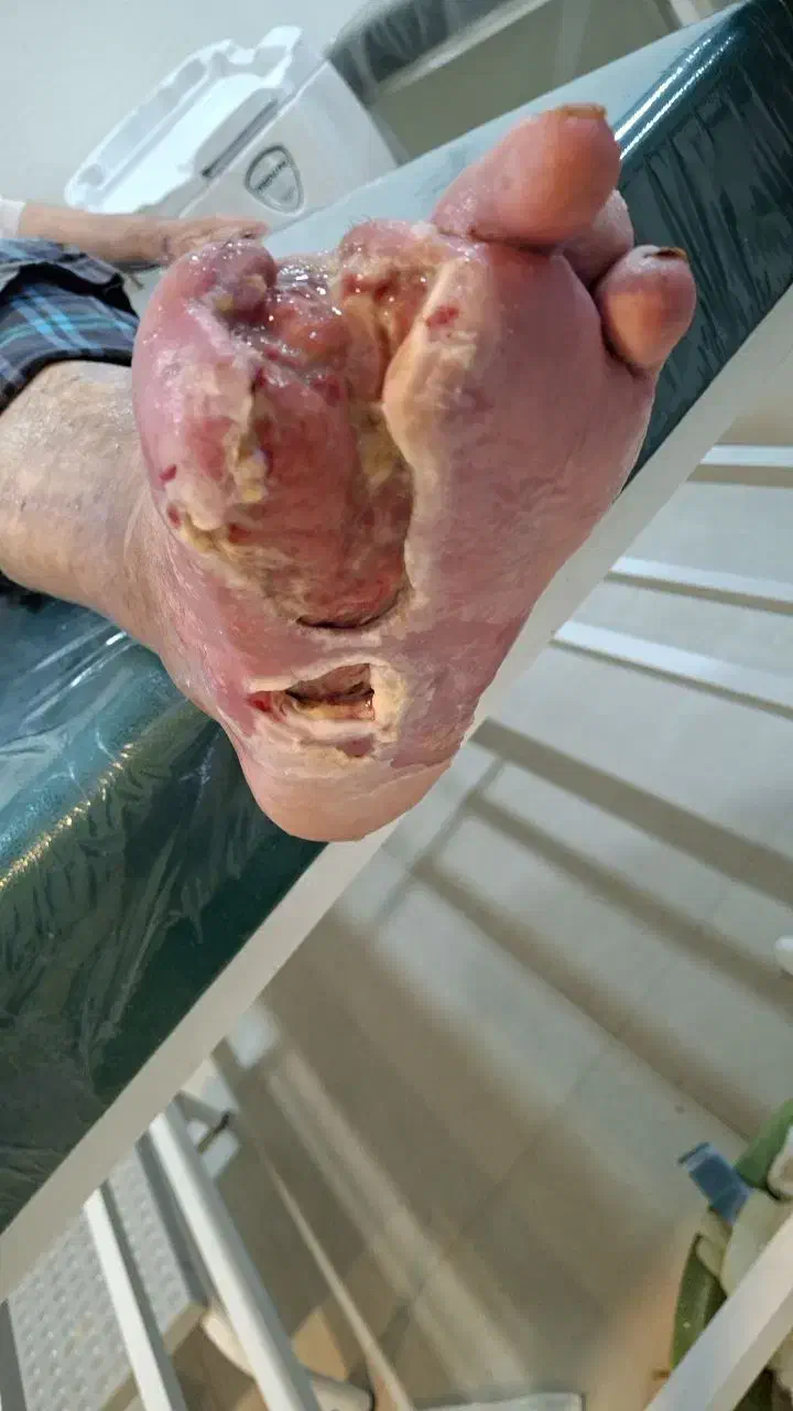 خدمات کلینیک تخصصی زخم و دیابت|خدمات آرایشگری و زیبایی|شهریار, شهریار|دیوار