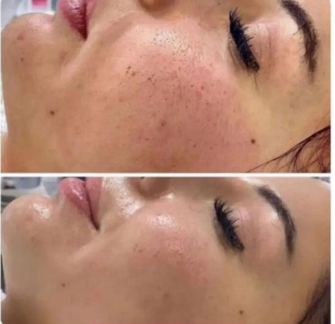 فشیال و تمامی خدمات پوستی|خدمات آرایشگری و زیبایی|خرم‌آباد, |دیوار